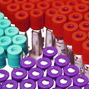 Inflammation Research Assays