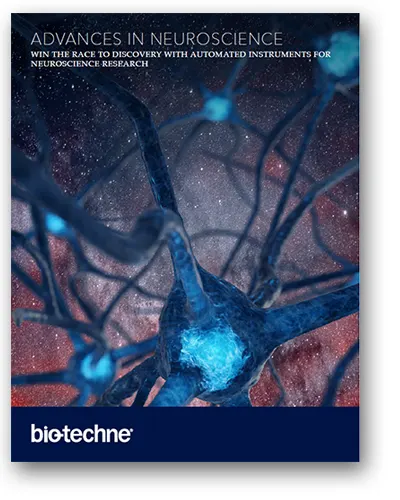Advances in neuroscience with Automated Western Blotting Solutions